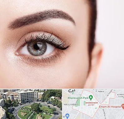 فوق تخصص عنبیه در جهانشهر کرج 