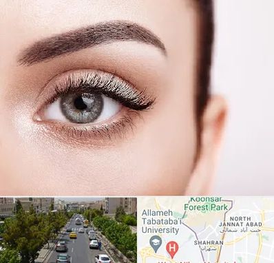 فوق تخصص عنبیه در شهران 