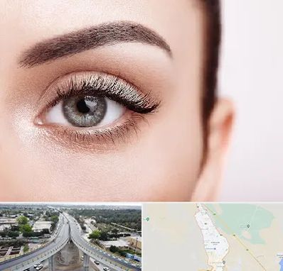 فوق تخصص عنبیه در اندیمشک