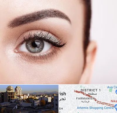 فوق تخصص عنبیه در فرمانیه 