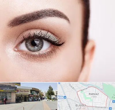 فوق تخصص عنبیه در پرواز تبریز