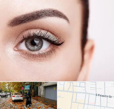 فوق تخصص عنبیه در خیابان فلسطین