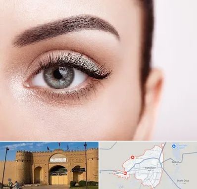فوق تخصص عنبیه در ایرانشهر