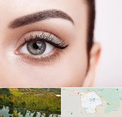 فوق تخصص عنبیه در بهبهان