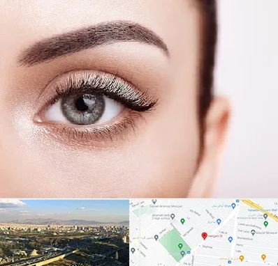 فوق تخصص عنبیه در هنگام 