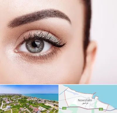 فوق تخصص عنبیه در نوشهر