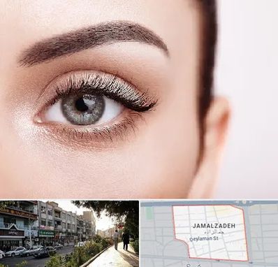 فوق تخصص عنبیه در خیابان جمالزاده