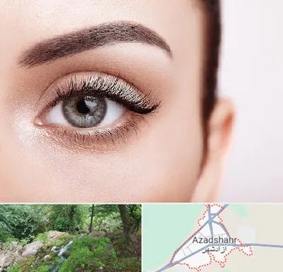 فوق تخصص عنبیه در آزادشهر