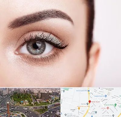 فوق تخصص عنبیه در سبلان 