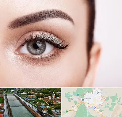 فوق تخصص عنبیه در مراغه