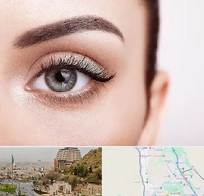 فوق تخصص عنبیه در فرهنگ شهر شیراز