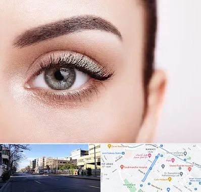 فوق تخصص عنبیه در خیابان ملاصدرا شیراز