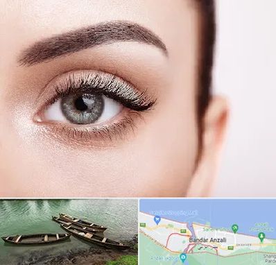 فوق تخصص عنبیه در بندر انزلی