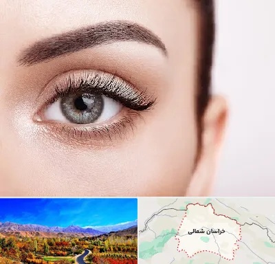 فوق تخصص عنبیه در خراسان شمالی
