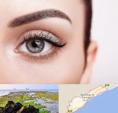 فوق تخصص عنبیه در بندرلنگه