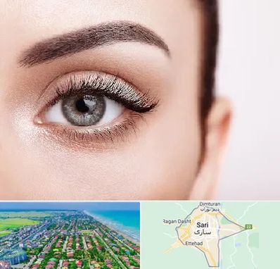 فوق تخصص عنبیه در ساری