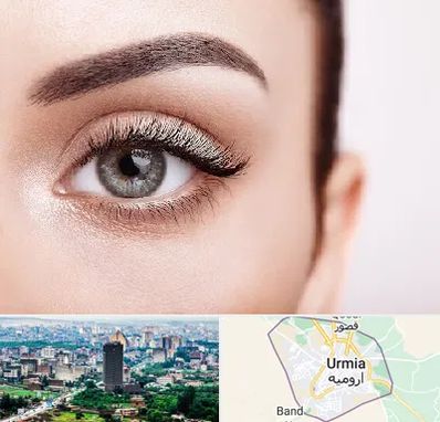 فوق تخصص عنبیه در ارومیه