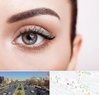 فوق تخصص عنبیه در بلوار معلم مشهد 