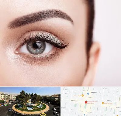 فوق تخصص عنبیه در هفت حوض 