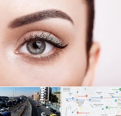 فوق تخصص عنبیه در پیروزی 