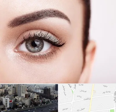 فوق تخصص عنبیه در زرتشت