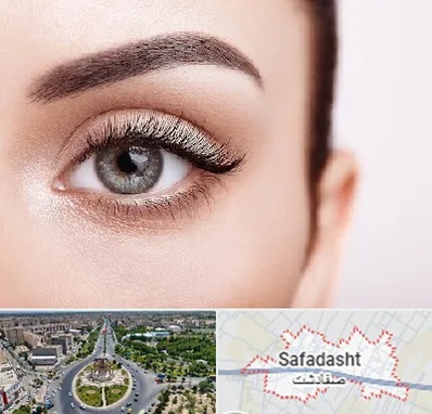 فوق تخصص عنبیه در صفادشت
