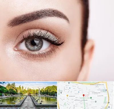 فوق تخصص عنبیه در سرسبز 