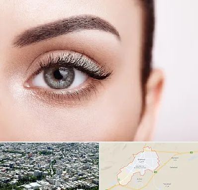 فوق تخصص عنبیه در شاهرود