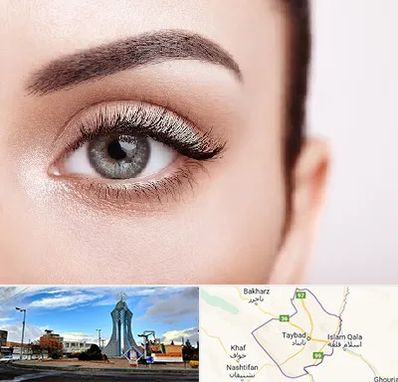 فوق تخصص عنبیه در تایباد