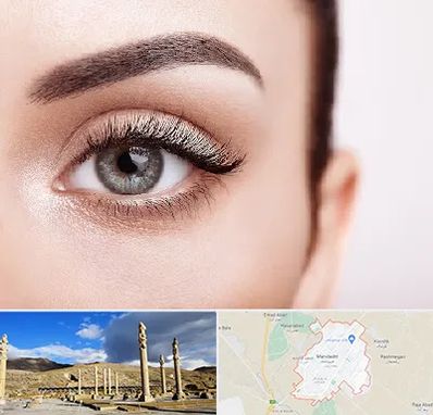 فوق تخصص عنبیه در مرودشت