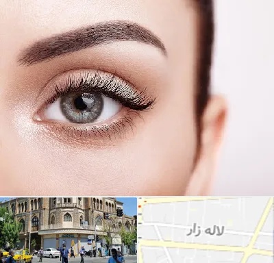 فوق تخصص عنبیه در لاله زار