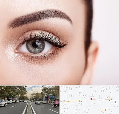 فوق تخصص عنبیه در دولت 