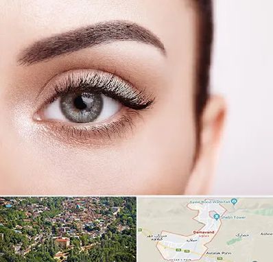 فوق تخصص عنبیه در دماوند