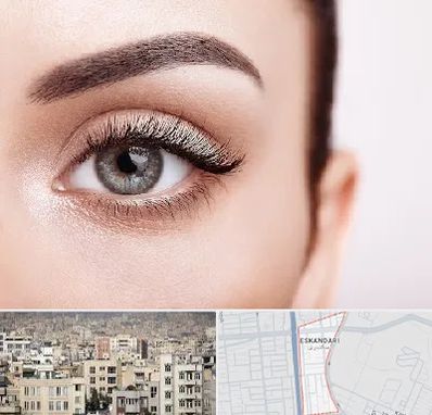 فوق تخصص عنبیه در اسکندری