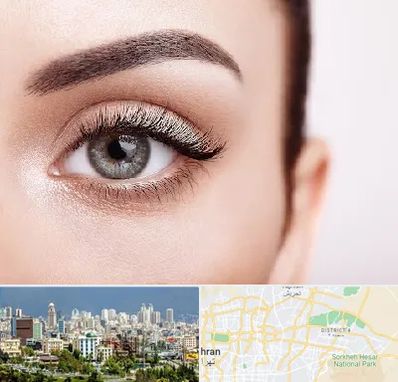 فوق تخصص عنبیه در شرق تهران 