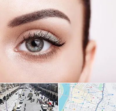 فوق تخصص عنبیه در نادری اهواز