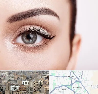 فوق تخصص عنبیه در جنوب شرق تهران