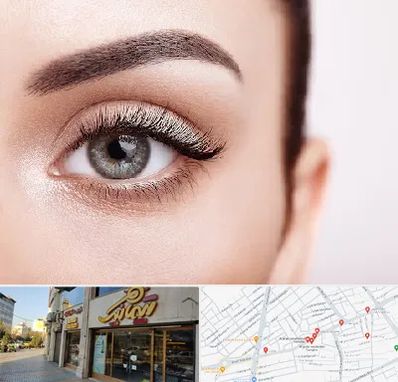 فوق تخصص عنبیه در عطاران قم