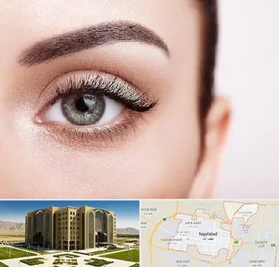 فوق تخصص عنبیه در نجف آباد