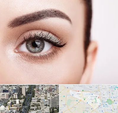 فوق تخصص عنبیه در منطقه 18 تهران 