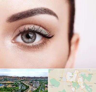 فوق تخصص عنبیه در شهریار