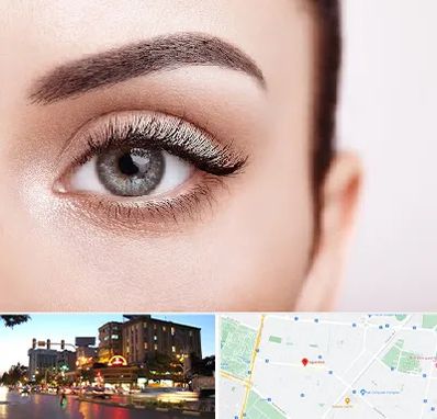 فوق تخصص عنبیه در بلوار سجاد مشهد 