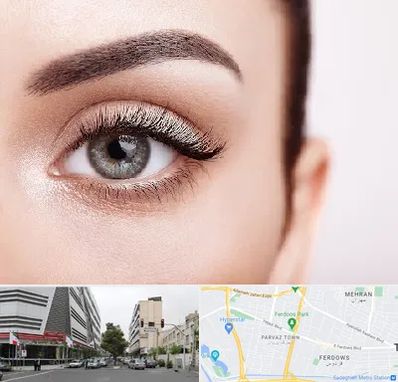 فوق تخصص عنبیه در بلوار فردوس 