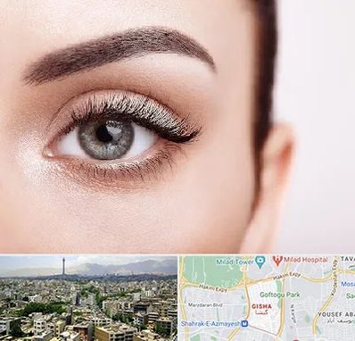 فوق تخصص عنبیه در گیشا 