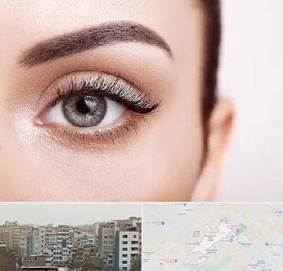 فوق تخصص عنبیه در محمد شهر کرج 