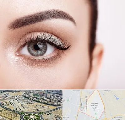 فوق تخصص عنبیه در اندیشه