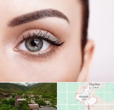 فوق تخصص عنبیه در کلاله