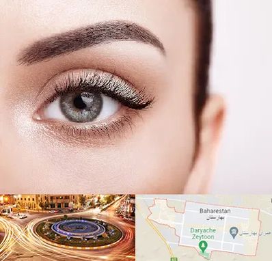 فوق تخصص عنبیه در بهارستان