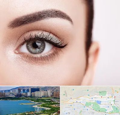 فوق تخصص عنبیه در منطقه 22 تهران 