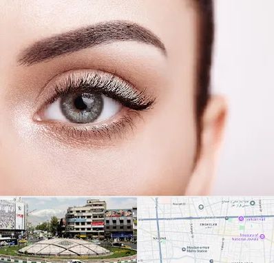 فوق تخصص عنبیه در مرکز تهران